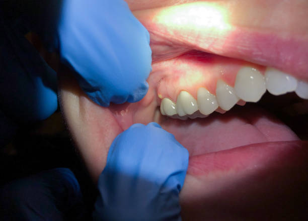 Best Cosmetic Emergency Dentistry in Monee, IL